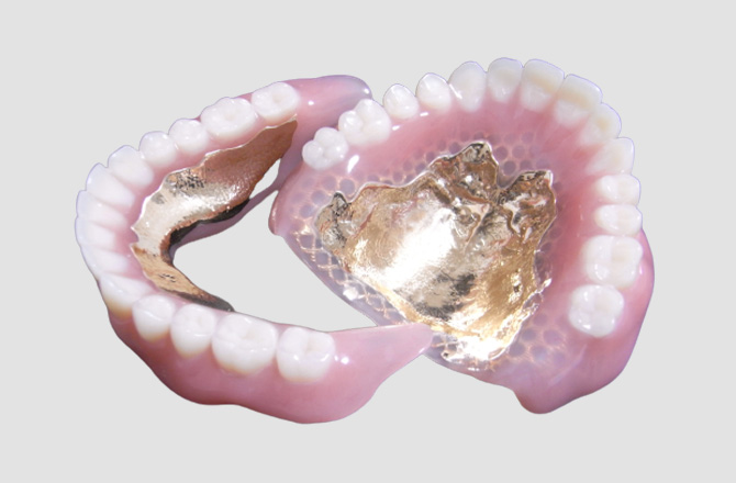 BPSデンチャーと一般的な入れ歯の違い